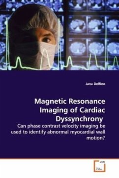 Magnetic Resonance Imaging of Cardiac Dyssynchrony - Delfino, Jana