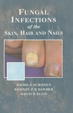 Fungal Infections of the Skin and Nails - Suhonen, Raimo E; Dawber, Rodney P R; Ellis, David H