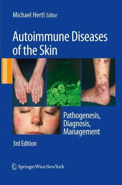 Autoimmune Diseases of the Skin - Hertl, Michael (Hrsg.)