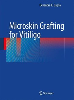 Microskin Grafting for Vitiligo - Gupta, Devendra K.