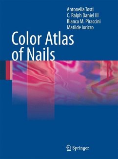 Color Atlas of Nails - Tosti, Antonella;Daniel, Ralph;Piraccini, Bianca Maria