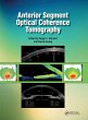Anterior Segment Optical Coherence... - Bild 1