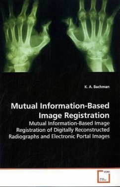 Mutual Information-Based Image Registration