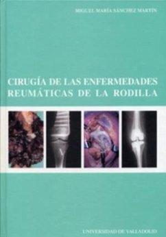 Cirugía de las enfermedades reumáticas de la rodilla - Sánchez Martín, Miguel María