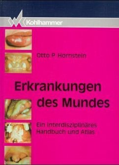 Erkrankungen des Mundes Erkrankungen des Mundes