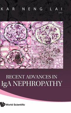 Recent Advances in IGA Nephropathy