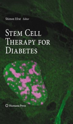 Stem Cell Therapy for Diabetes - Efrat, Shimon (Hrsg.)
