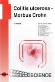 Colitis ulcerosa, Morbus Crohn