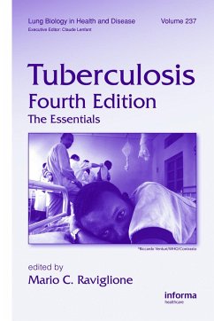 Tuberculosis