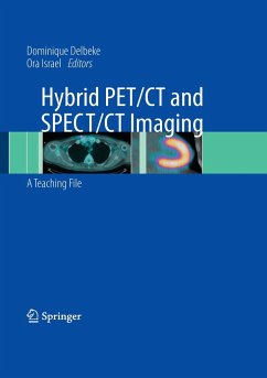 Hybrid PET/CT and SPECT/CT Imaging - Delbeke, Dominique / Israel, Ora (ed.)