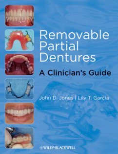 Removable Partial Dentures - Jones, John D.; Garcia, Lily T.