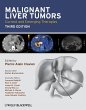 Malignant Liver Tumors - Bild 1