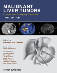 Malignant Liver Tumors - Clavien, Pierre-Alain / Breitenstein, Stefan / Belghiti, Jacques et al. (Hrsg.)