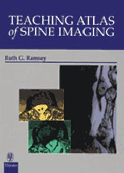 Teaching Atlas of Spine Imaging - Ramsey, Ruth G.