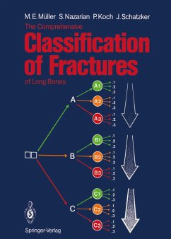 The Comprehensive Classification of Fractures of Long Bones - Müller, Maurice E.; Nazarian, Serge; Schatzker, Joseph; Koch, Peter