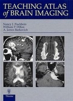 Teaching Atlas of Brain Imaging - Fischbein, Nancy J.; Dillon, William P.; Barkovich, A. J.