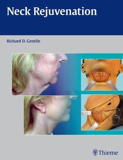 Neck Rejuvenation - Gentile, Richard D.