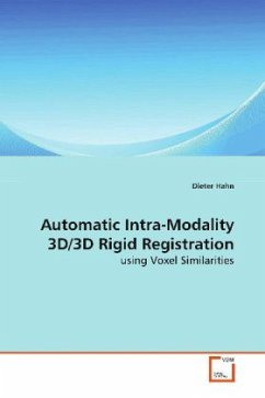 Automatic Intra-Modality 3D/3D Rigid Registration - Hahn, Dieter