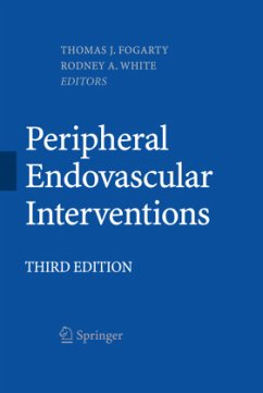 Peripheral Endovascular Interventions - Fogarty, Thomas J. / White, Rodney A. (Hrsg.)