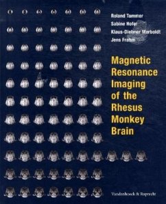 Magnetic Resonance Imaging of the Rhesus Monkey Brain