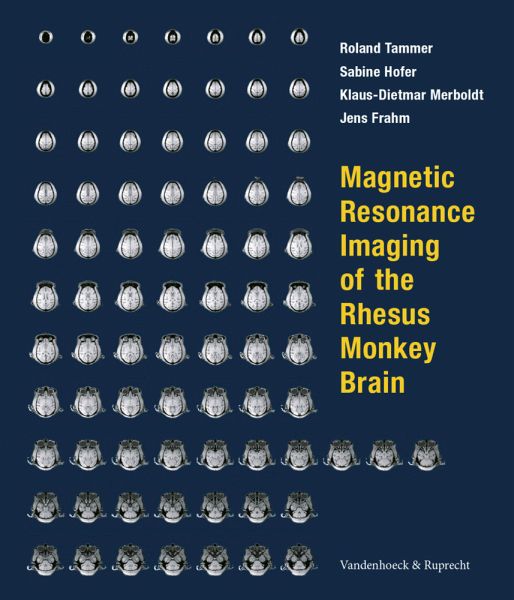 Magnetic Resonance Imaging of the Rhesus Monkey Brain Magnetic Resonance Imaging of the Rhesus Monkey Brain