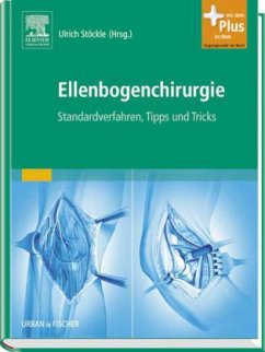Ellenbogenchirurgie - Stöckle, Ulrich (Hrsg.)