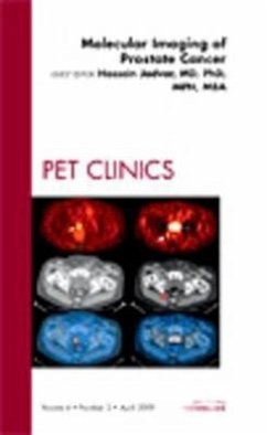 Molecular Imaging of Prostate Cancer, an Issue of Pet Clinics - Jadvar, Hossein