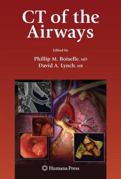 CT of the Airways - Boiselle, Phillip M. / Lynch, David A. (Hrsg.)