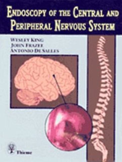 Endoscopy of the Central and Peripheral Nervous System - King, Wesley A.;Frazee, John G.;DeSalles, Antonio A. F.