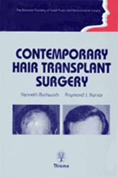 Contemporary Hair Transplant Surgery - Buchwach, Kenneth A.;Konior, Raymond J.