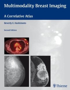Cover Multimodality Breast Imaging