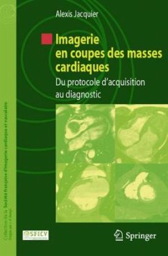 Imagerie en coupes des masses cardiaques - Jacquier, Alexis