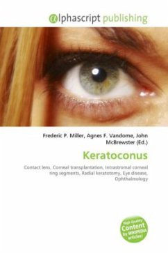 Keratoconus