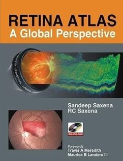 Retina Atlas: A Global Perspective - Saxena, Sandeep; Saxena, R C