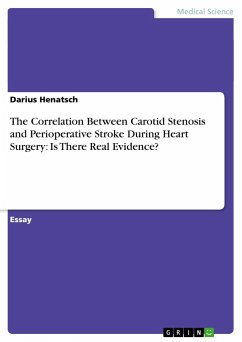 The Correlation Between Carotid Stenosis and Perioperative Stroke During Heart Surgery: Is There Real Evidence? - Henatsch, Darius