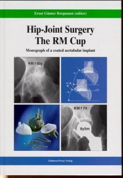 Hip-Joint Surgery, The RM Cup - Hip-Joint Surgery - The RM Cup: Monograph of a coated acetabular implant Bergmann, Ernst G