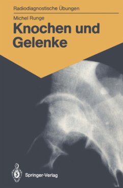 Knochen und Gelenke - Runge, Michel