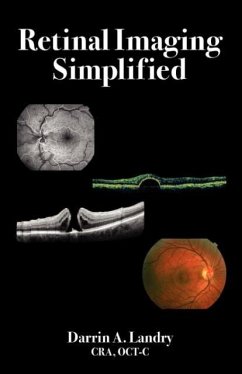 Retinal Imaging Simplified - Landry, Darrin A