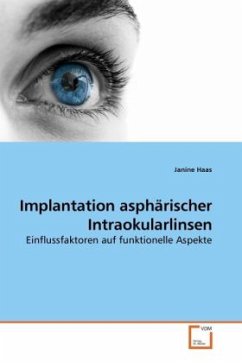 Implantation asphärischer Intraokularlinsen - Haas, Janine