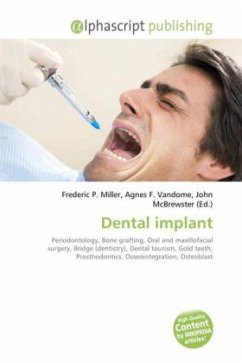 Dental implant Dental implant