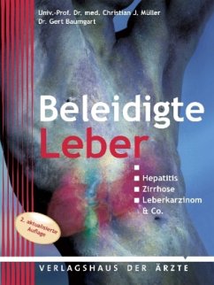 Beleidigte Leber - Baumgart, Gert;Müller, Christian J.