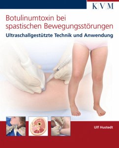 Botulinumtoxin bei spastischen Bewegungsstörungen - Hustedt, Ulf