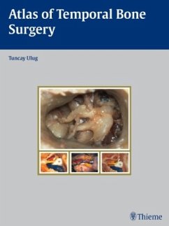 Atlas of Temporal Bone Surgery - Ulug, Tuncay