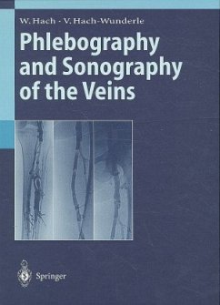 Phlebography and Sonography of the Veins - Hach, Wolfgang; Hach-Wunderle, Viola