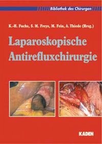 Laparoskopische Antirefluxchirurgie