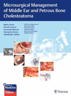 Microsurgical Management of Middle Ear and Petrous Bone Cholesteatoma - Mario Sanna; Hiroshi Sunose; Fernando Mancini; Alessandra Russo; Abdelkader Taibah