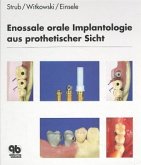 Enossale orale Implantologie aus prothetischer Sicht