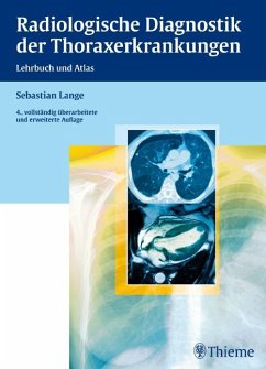 Radiologische Diagnostik der Thoraxerkrankungen - Lange, Sebastian