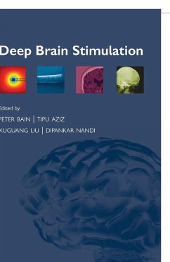 Deep Brain Stimulation - Bain, Peter; Aziz, Tipu; Liu, Xuguang