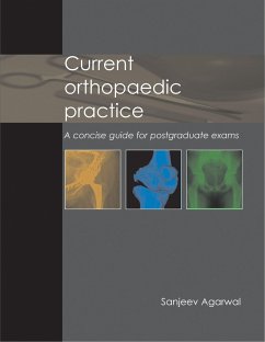Current Orthopaedic Practice: A Concise Guide for Postgraduate Exams - Agarwal, Sanjeev